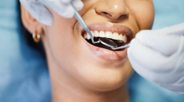 Best Emergency Dental Care for Broken or Chipped Teeth in Golden Gate, FL
