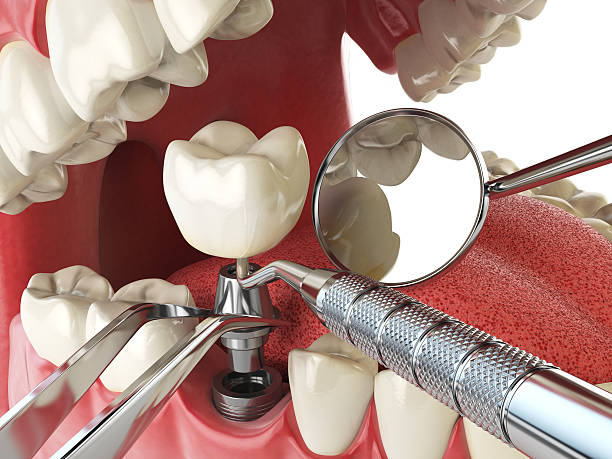 Best Cosmetic Emergency Dentistry in Golden Gate, FL